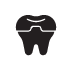 Dental Crowns